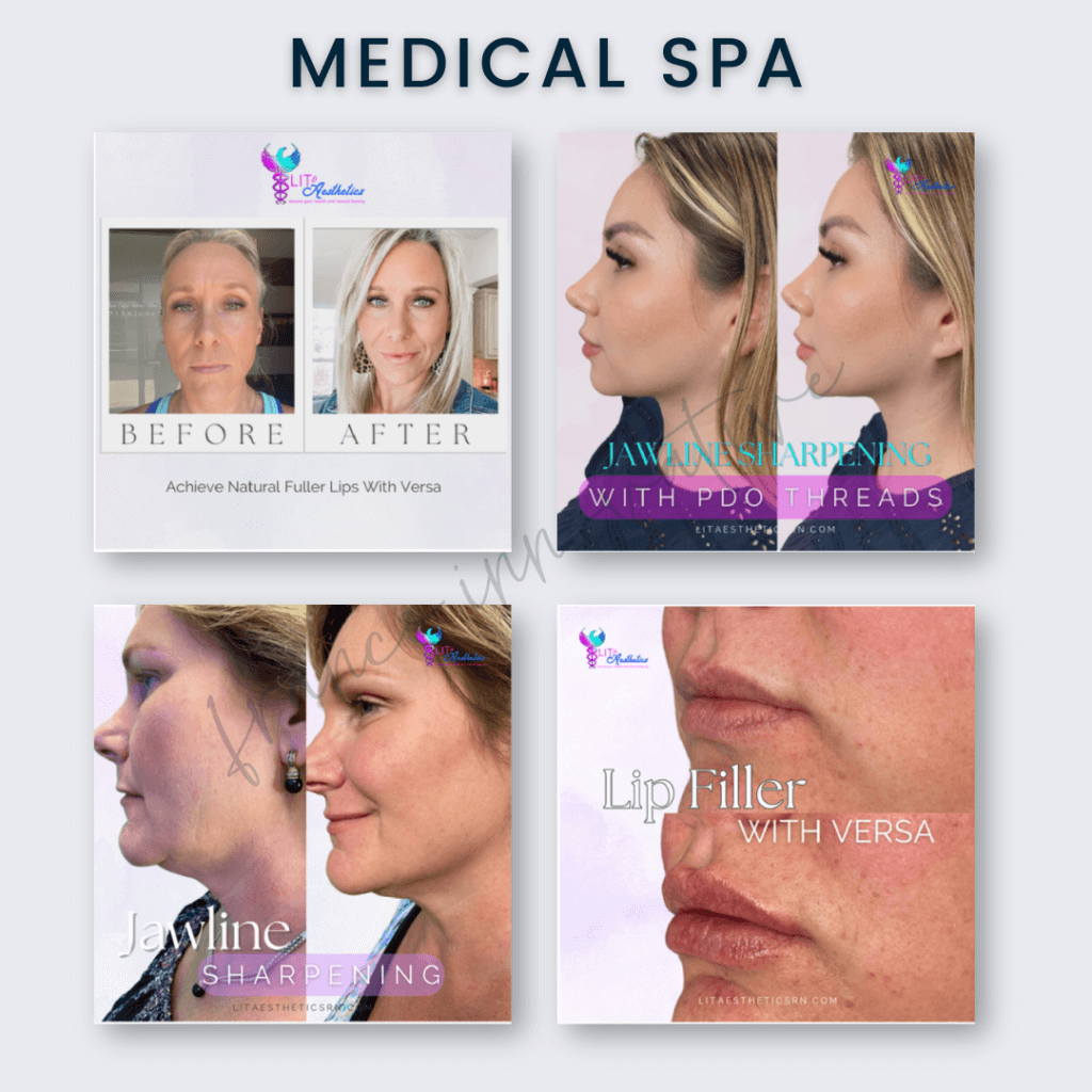 Med Spa Marketing Mastery: Leveraging Social Media For 
Med Spas